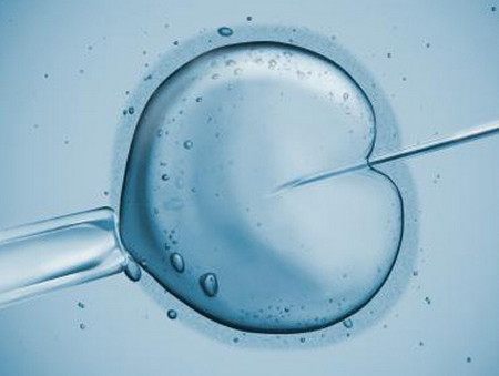 无精症案例